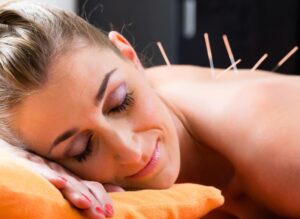 Dry Needling vs. Acupuncture: Which is Right for You?